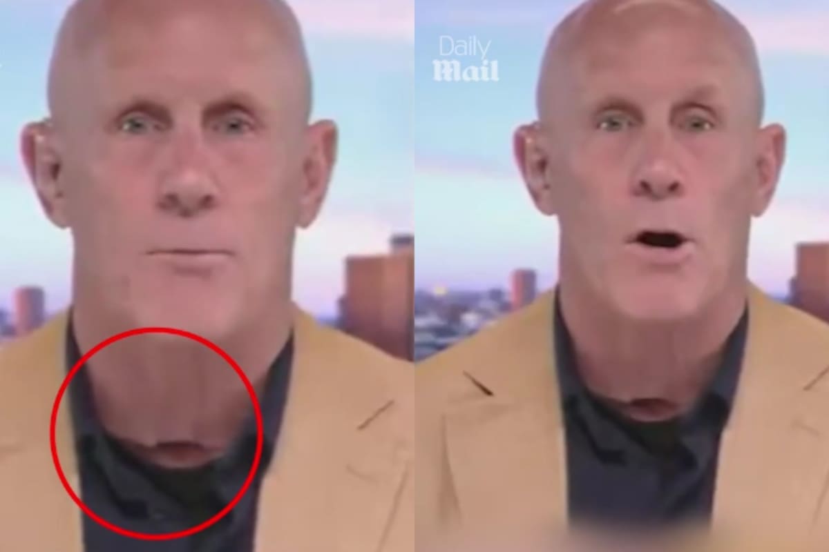 “Esto no es normal” Presentador de Fox News continúa causando revuelo en internet por su apariencia