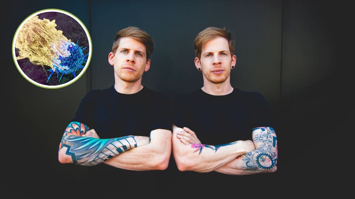 Los tatuajes mayores que la palma de una mano presentaron las asociaciones más altas con linfoma y cáncer de piel dentro de un estudio danés publicado en 2025
