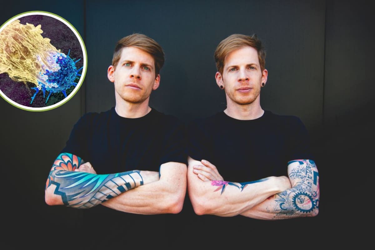 Los tatuajes mayores que la palma de una mano presentaron las asociaciones más altas con linfoma y cáncer de piel dentro de un estudio danés publicado en 2025
