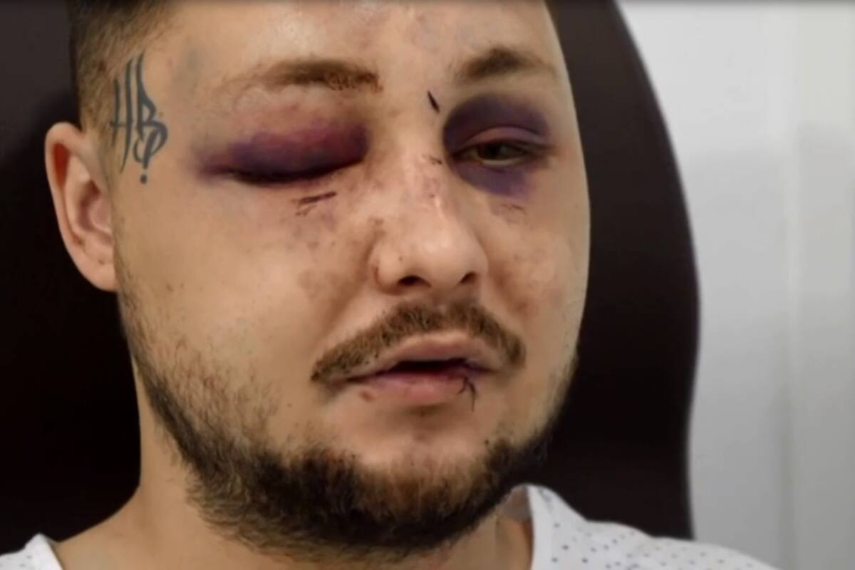 Joven termina en hospital por defender a desconocida de su novio