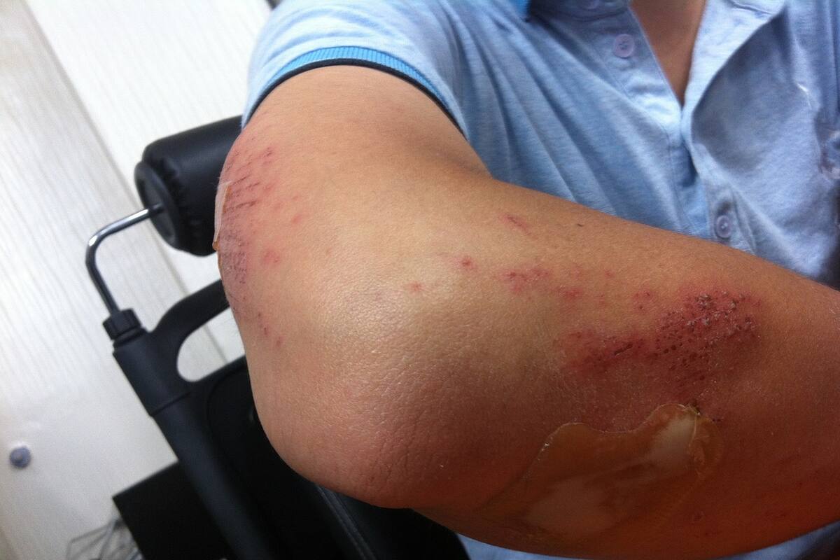 Hombre se encuentra grave tras golpiza recibida