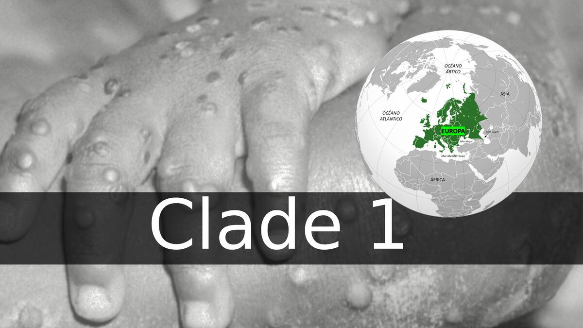 La variante mpox Clade 1 fue detectada en Suecia, primer caso de viruela del mono en Europa, confirmado por la OMS.