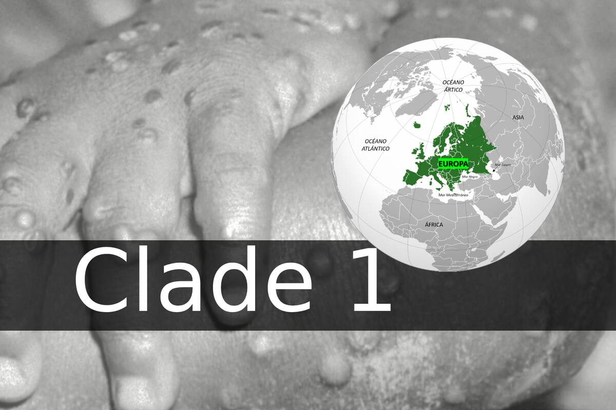 ¿Qué es clade 1, variante de mpox detectada en Europa?
