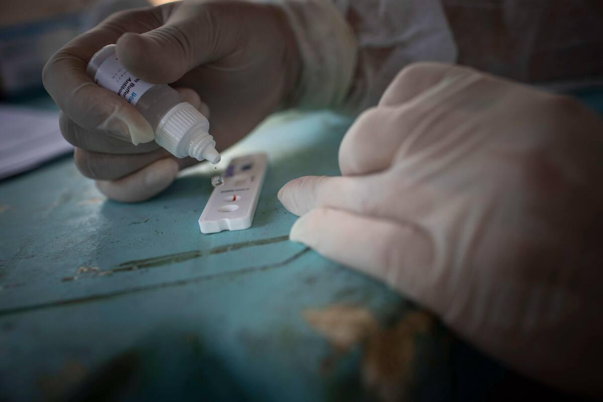 Derrames cerebrales son más graves en pacientes con Covid-19, alertan expertos