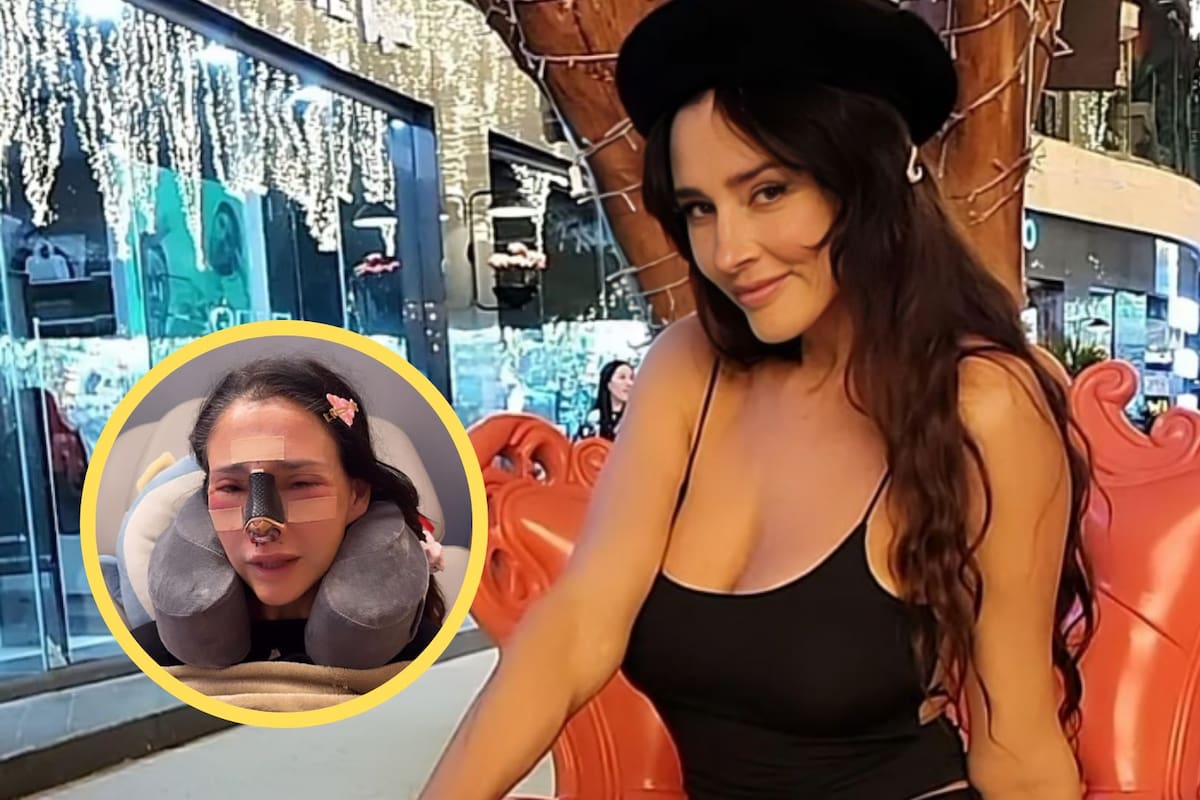 Rinoplastia: los riesgos y cuidados que implica un procedimiento como el que se atribuye a Dorismar
