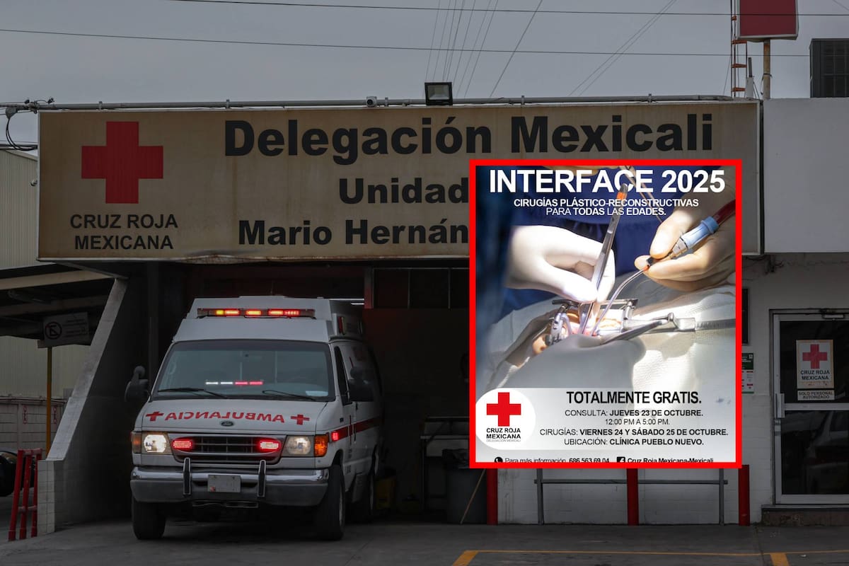 Un acto de humanidad: Cruz Roja invita a jornada gratuita de cirugías reconstructivas