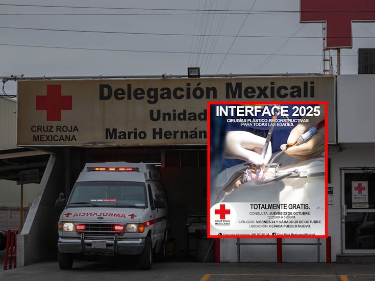 Un acto de humanidad: Cruz Roja invita a jornada gratuita de cirugías reconstructivas