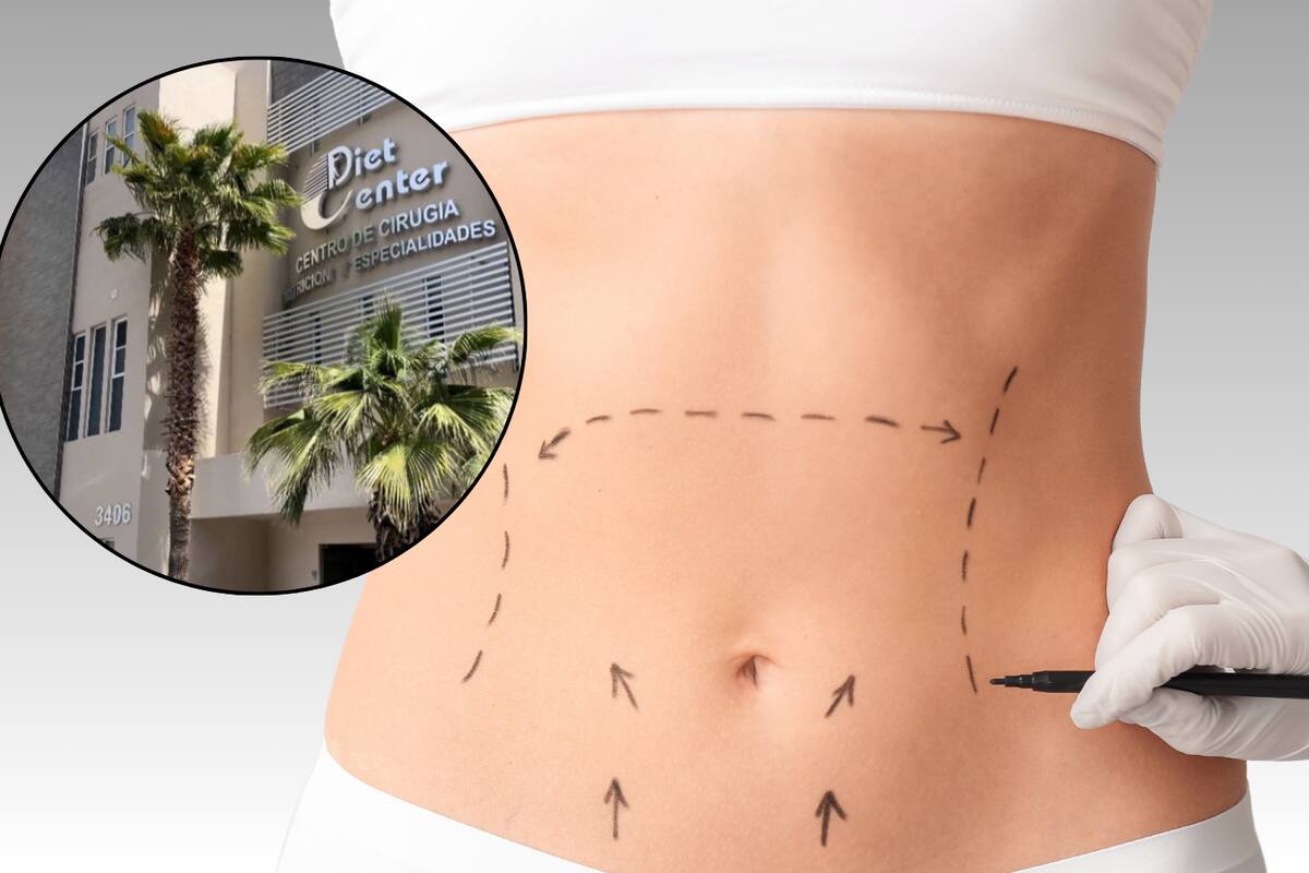 Prometía cuerpos perfectos y dejó tragedias: denuncian a cirujano plástico en Chihuahua