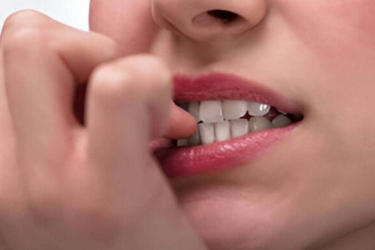 ¿Por qué no es recomendable comerse las uñas? Esto dicen los expertos
