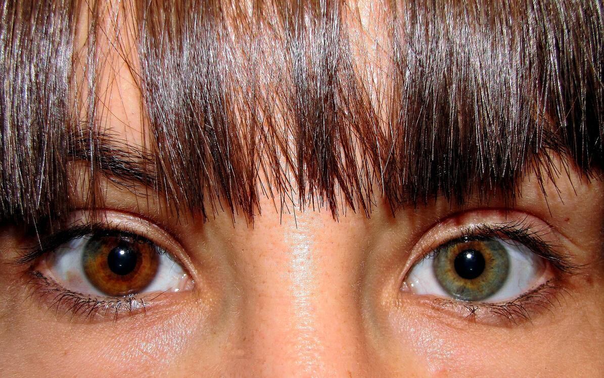 La heterocromía es una condición en la que los ojos tienen diferentes colores.