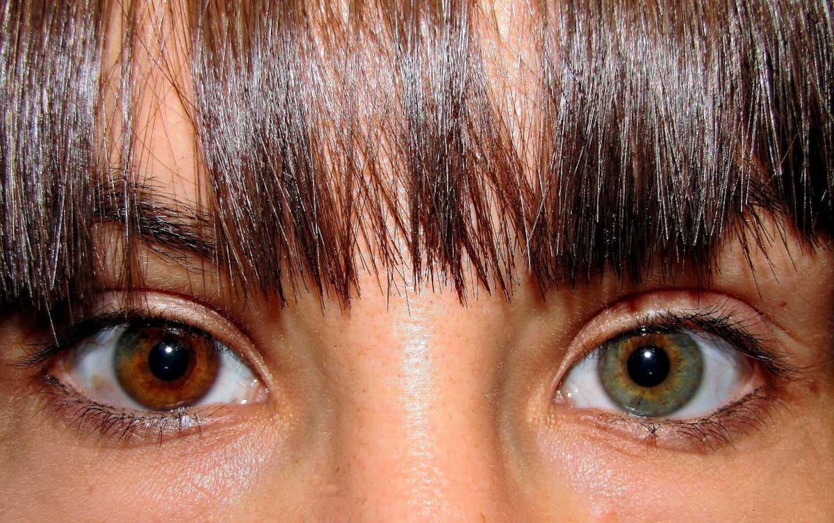 La heterocromía es una condición en la que los ojos tienen diferentes colores.