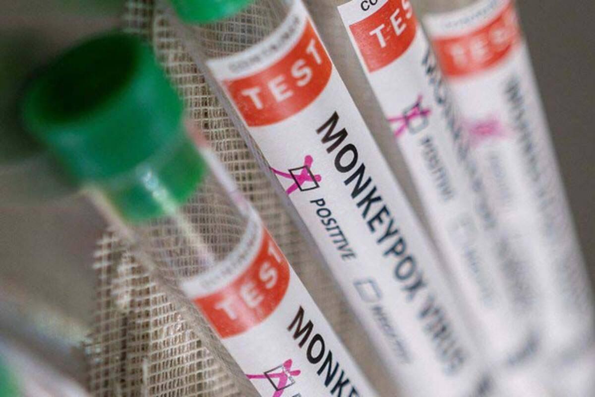 Chile: Se confirma segundo caso de viruela del mono