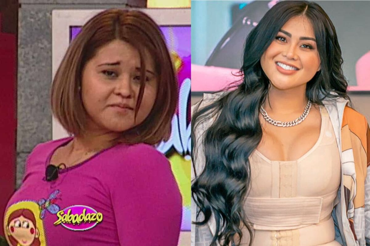 Gomita se ha sometido a varias cirugías estéticas. Instagram.