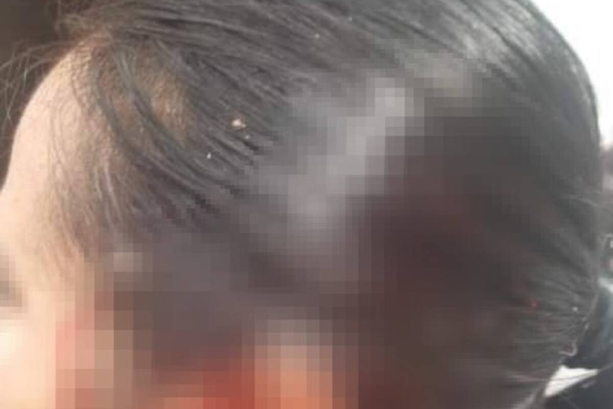 Solicita protección de autoridades tras agresión de vecinos