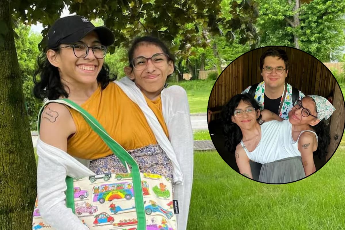 Así es la vida marital de Carmen, siamesa mexicana, junto a su esposo y hermana
