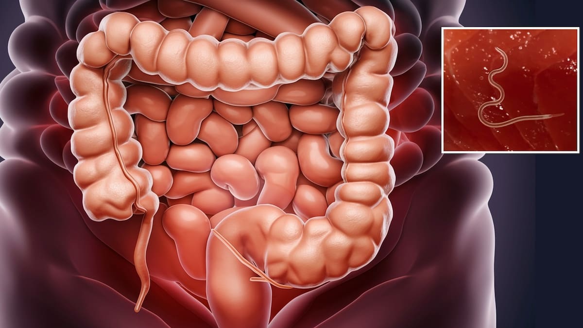 Experto recomienda desparasitarse al menos cada seis meses para tener una buena salud digestiva, además de aplicar otras medidas en casa y en la calle para evitar riesgos en la salud