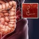 Experto recomienda desparasitarse al menos cada seis meses para tener una buena salud digestiva, además de aplicar otras medidas en casa y en la calle para evitar riesgos en la salud