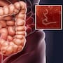 Experto recomienda desparasitarse al menos cada seis meses para tener una buena salud digestiva, además de aplicar otras medidas en casa y en la calle para evitar riesgos en la salud