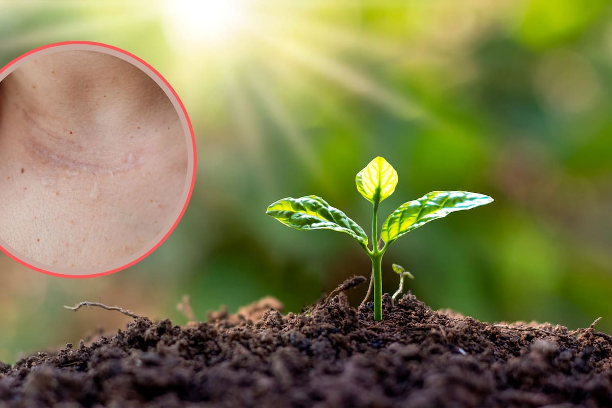 Descubren la planta que acelera la cicatrización y actúa como laxante natural
