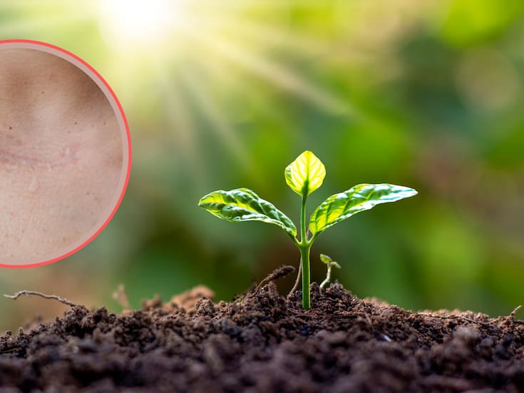 Descubren la planta que acelera la cicatrización y actúa como laxante natural