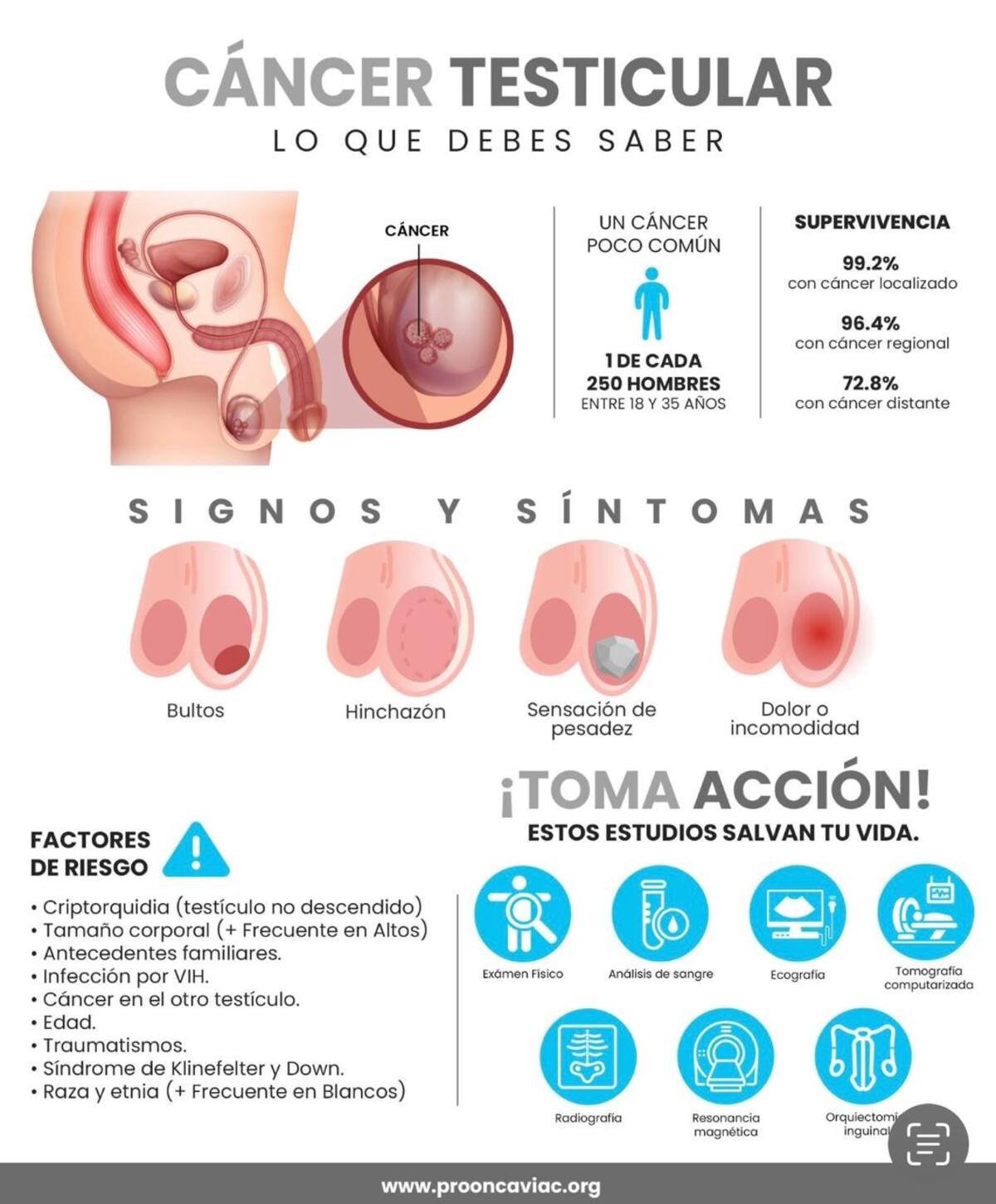 Lo que debes saber del cáncer testicular.