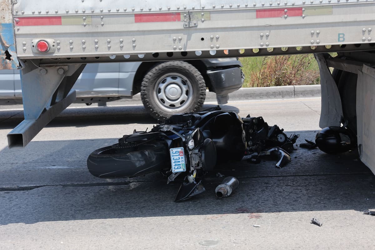 Motociclista pierde la pierna izquierda al impactarse contra tráiler