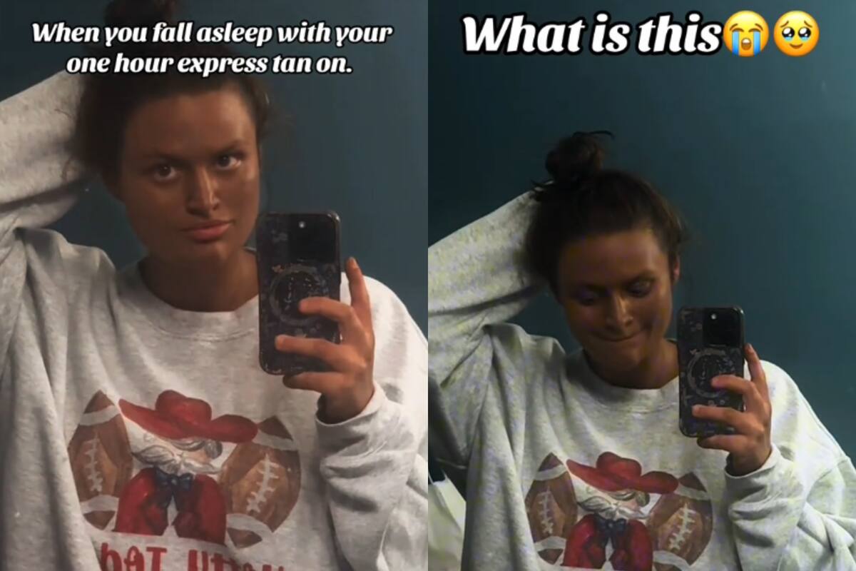 TikTok: Mujer se queda dormida mientras se broncea: así lucía cuando despertó 8 horas después