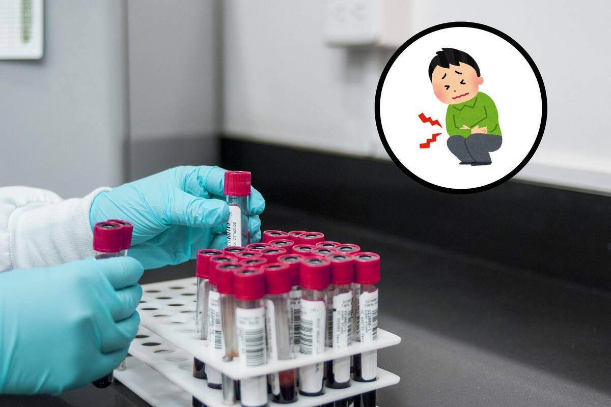 ¿Cuáles son los síntomas de tener triglicéridos altos?