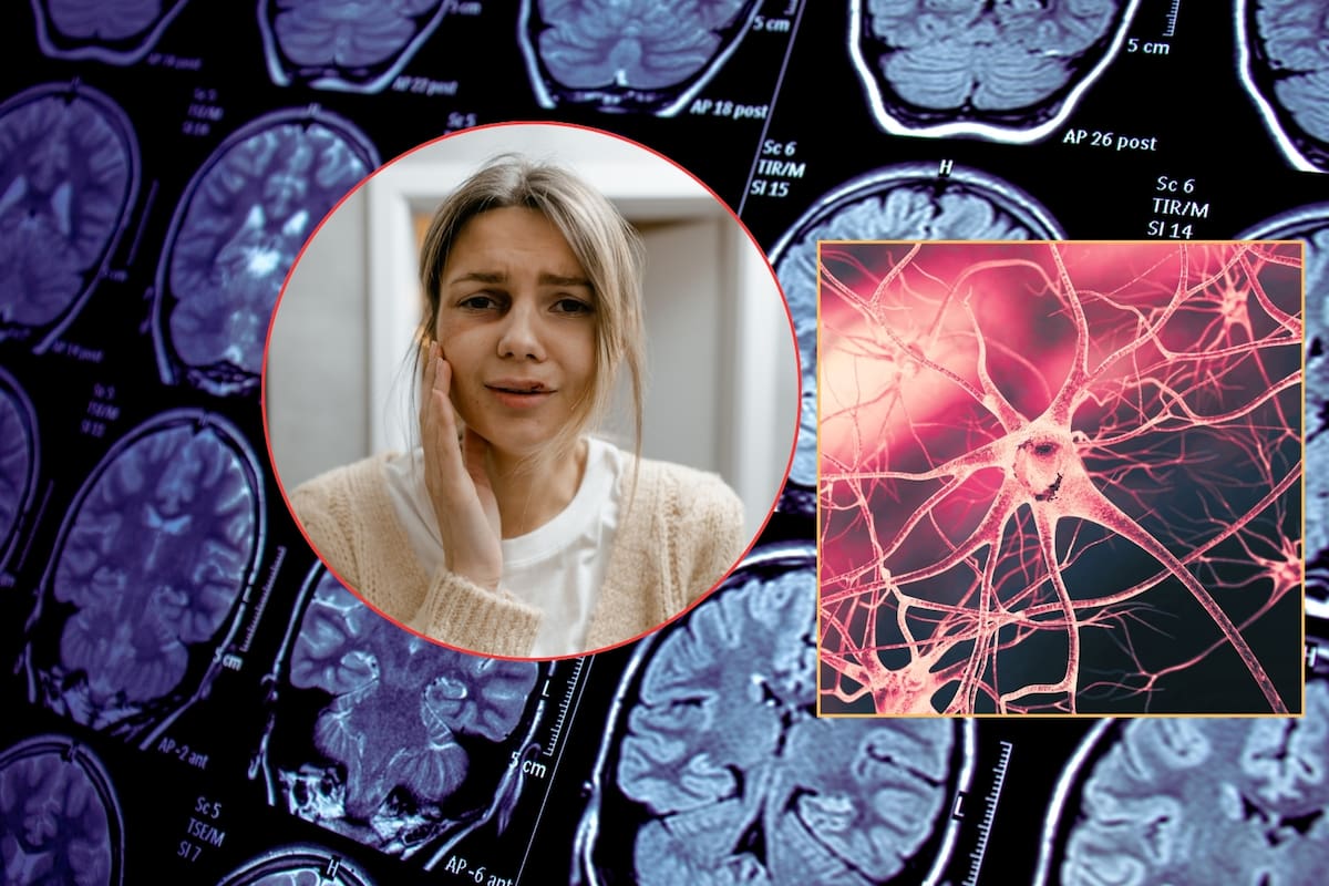 ¿Qué es la neuralgia del trigémino? Doctor advierte sobre la rara enfermedad que provoca uno de los peores dolores que puede experimentar el ser humano