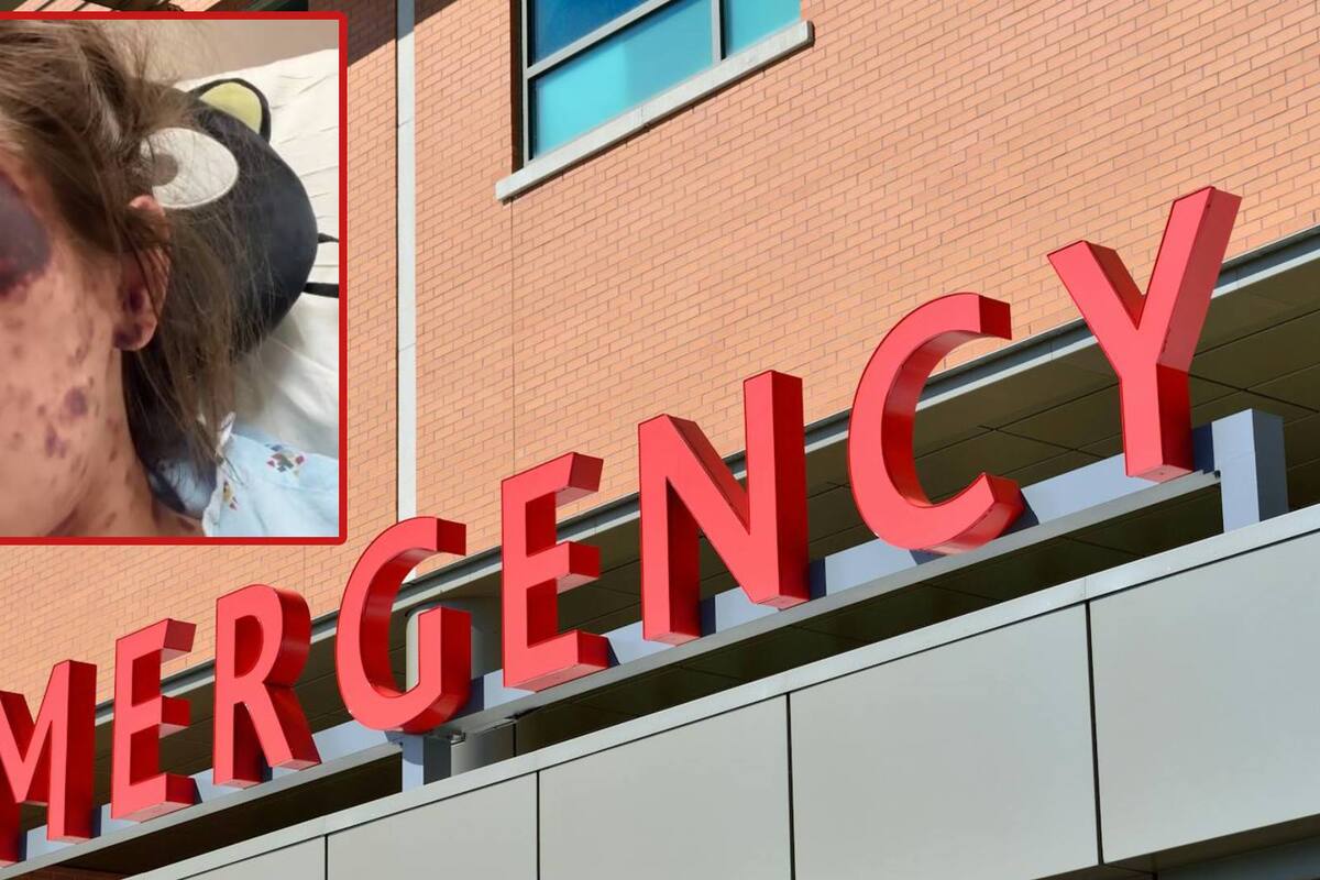 Su piel se puso morada y casi queda ciega al recibir tres vacunas como requisito para realizarse una transfusión de sangre