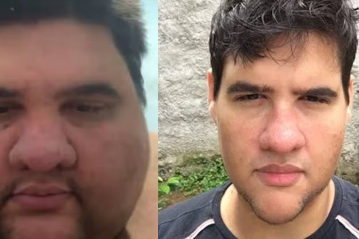 Fallece Gabriel Freitas, el influencer brasileño que inspiró al mundo tras bajar más de 200 kg en un año y medio