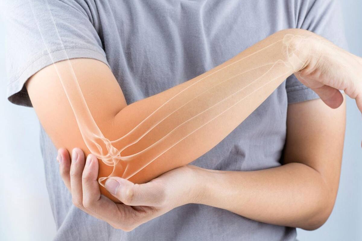 ¿Cuáles son las siete complicaciones de la osteoporosis?