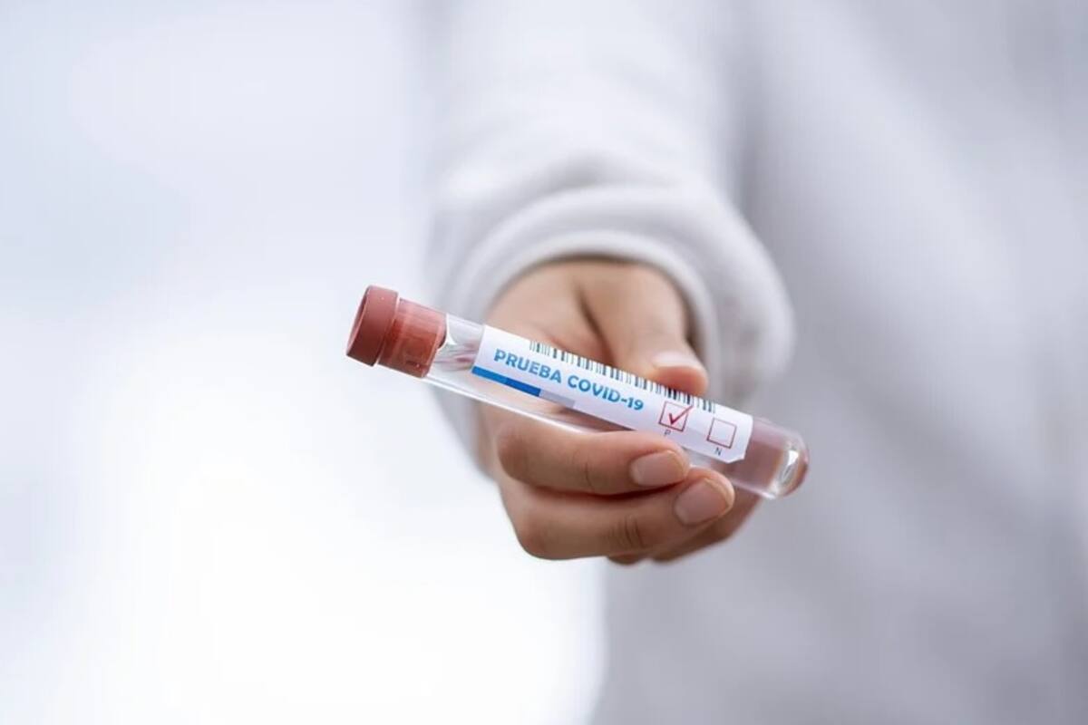 Aprueba Cofepris siete pruebas rápidas para detectar Covid-19