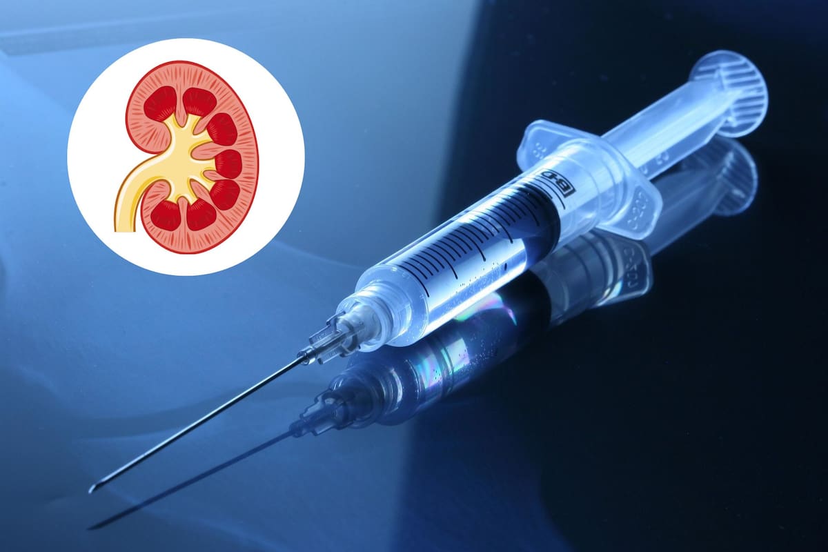 Nueva vacuna experimental muestra avances contra cáncer de riñón avanzado