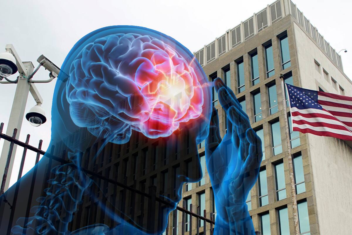 Posibles ataques rusos detrás del “Síndrome de La Habana”