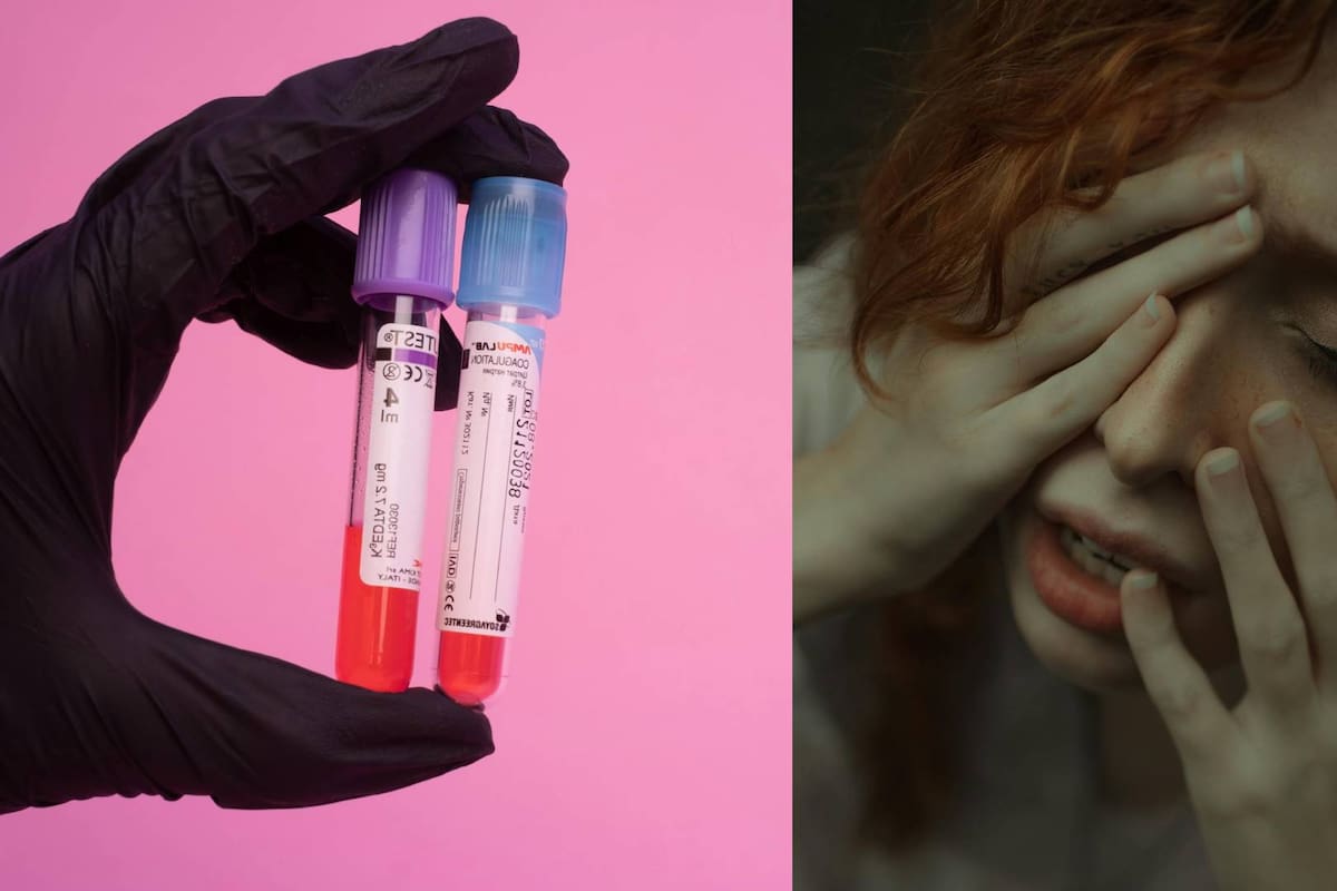 La ‘maldición celta’, la extraña enfermedad hereditaria que afecta en su mayoría a los irlandeses