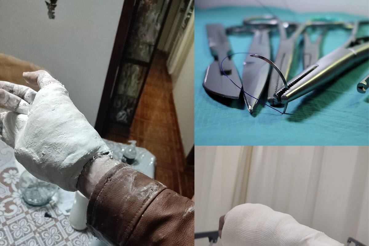 Paciente del IMSS denuncia que le enyesaron la mano y no se puede quitar la chamarra