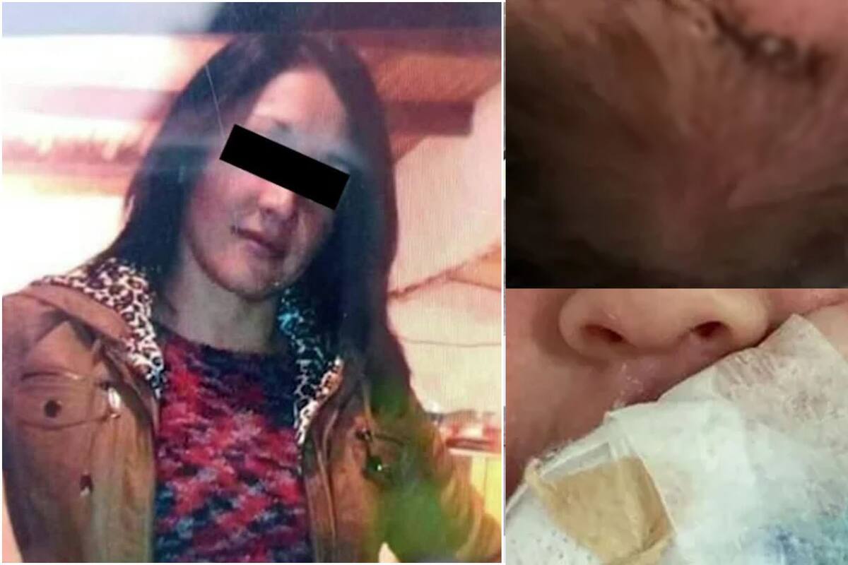 Bebé cae de cabeza al salir del vientre de su mamá y necesitó sutura