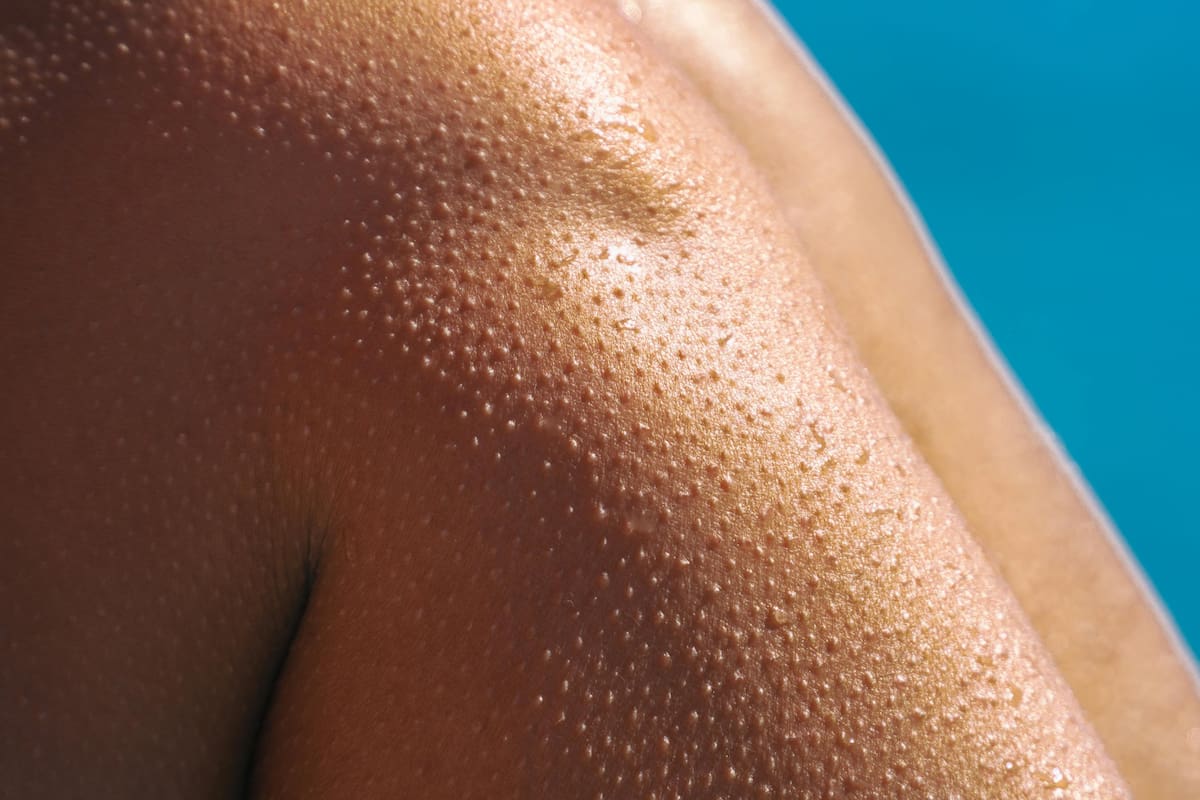 ¿Por qué nos da la “piel de gallina”?