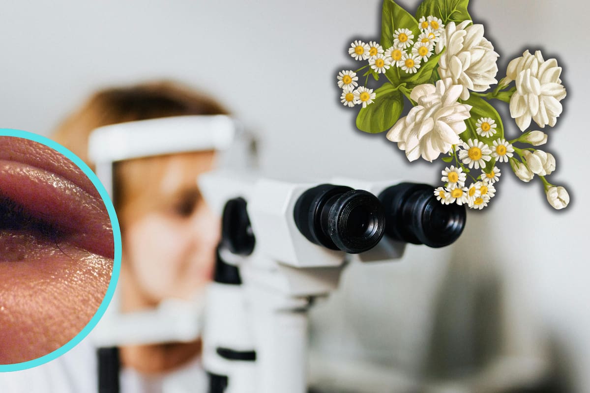 Orzuelo: qué es, cómo aliviarlo y cuándo acudir al médico