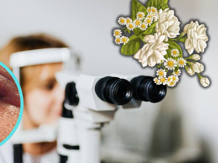 Orzuelo: qué es, cómo aliviarlo y cuándo acudir al médico