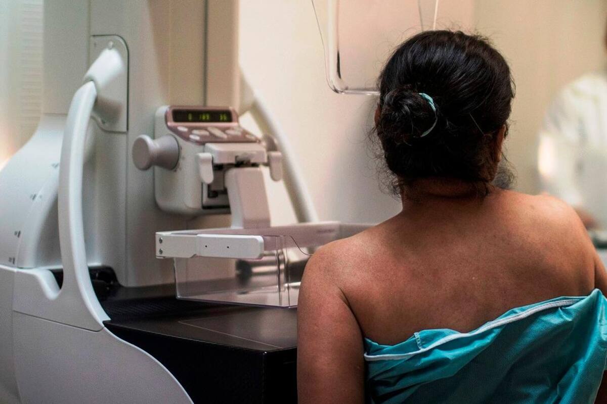 Otorgarán 500 mastografías gratuitas en Tijuana
