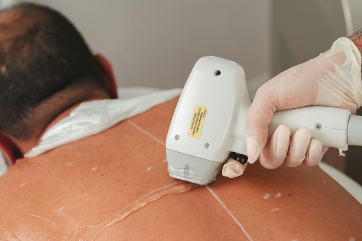 Depilación corporal masculina: técnicas, beneficios y precauciones
