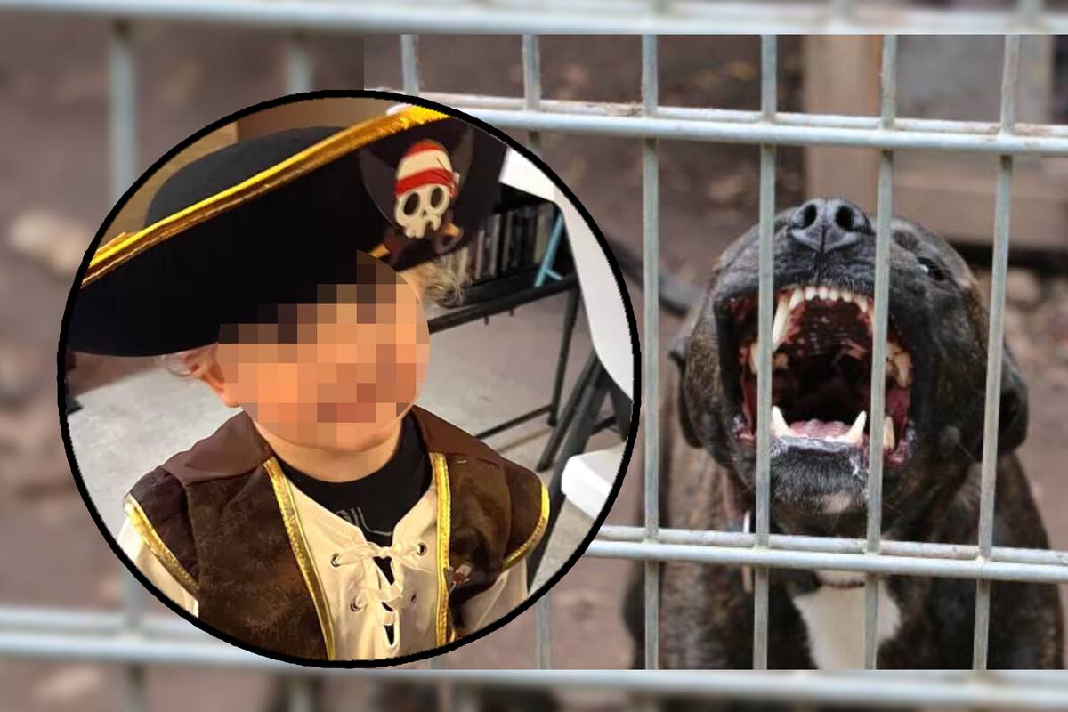 Niño de 3 años es atacado brutalmente por pitbulls junto a su madre; no se espera que sobreviva y deciden donar sus órganos