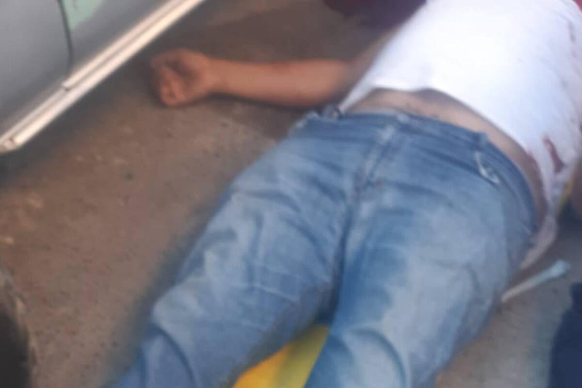 Hieren de bala en la cabeza a hombre en Tecate