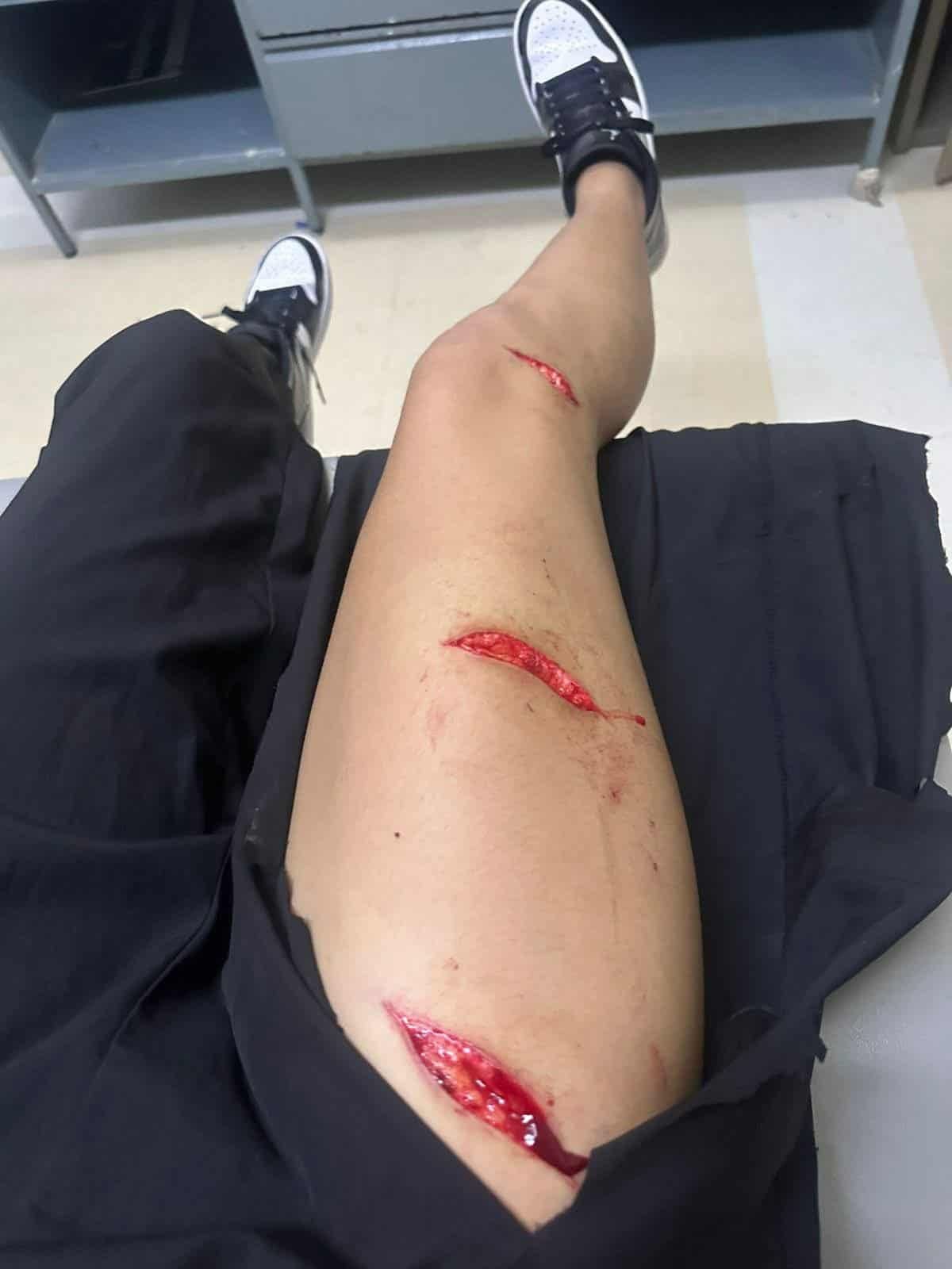 La víctima fue herida al tirar basura; el caso se difundió ampliamente en redes sociales. Foto: Especial