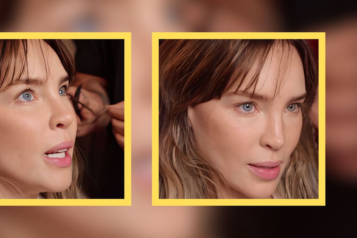 Especialista revela posible lifting facial de Belinda tras video viral
