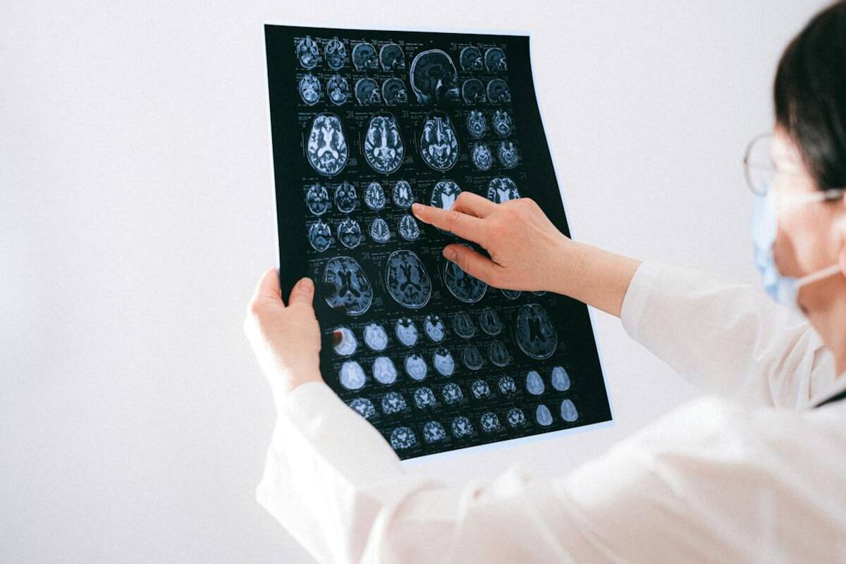 Estudio explica si el cerebro permanece consciente después de la muerte