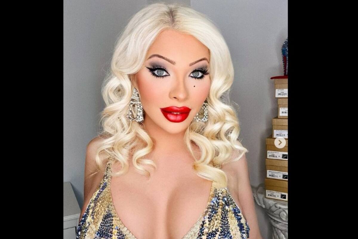 Gasta más de un millón de pesos en cirugías para verse como Marilyn Monroe