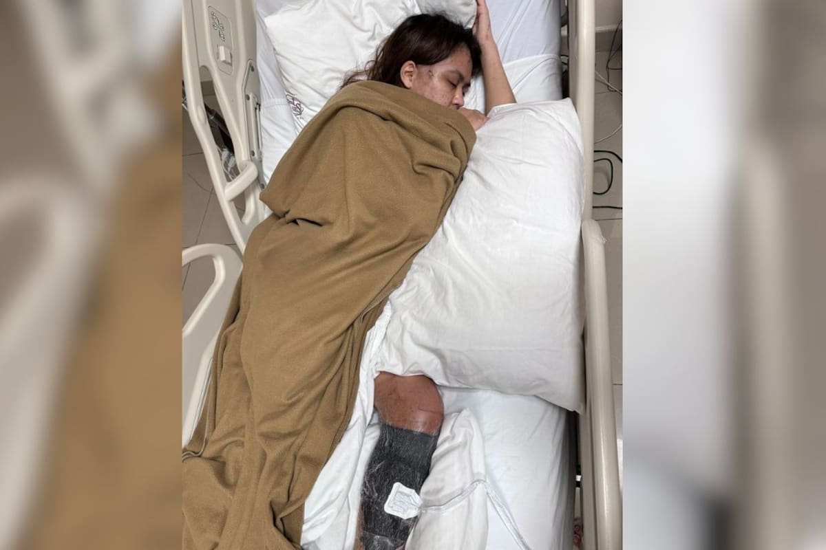 Familia organiza rifas para costear cirugía de Kitzia, joven afectada por accidente automovilístico